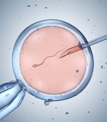 in vitro fertilization